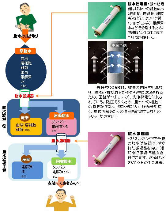 CARTとは