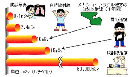 透視検査